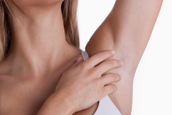 papilloma under a woman's armpits
