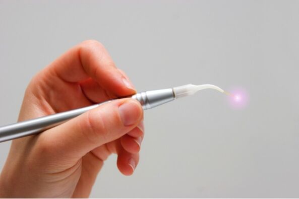laser for papilloma removal